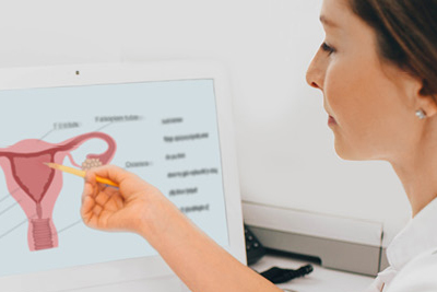 Un profesional de la salud consulta una ilustración médica del aparato reproductor de la mujer en la pantalla de su computadora.