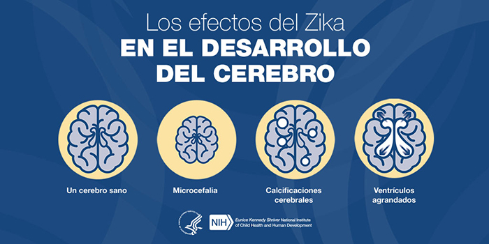 Los efectos del Zika en el desarrollo del cerebro