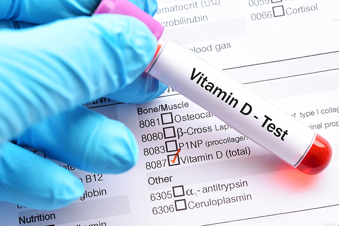 Una mano enguantada sostiene un tubo de ensayo marcado como "Prueba de vitamina D", frente a una lista de verificación de pruebas médicas, con la casilla "Prueba de vitamina D" marcada.