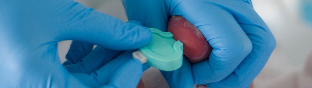 Un profesional médico con guantes de goma realiza una punción en el talón para pruebas de detección para recién nacidos en el pie de un bebé recién nacido.