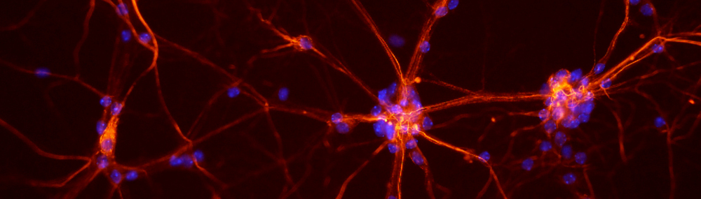 Neuronas fluorescentes de la médula espinal de un ratón.