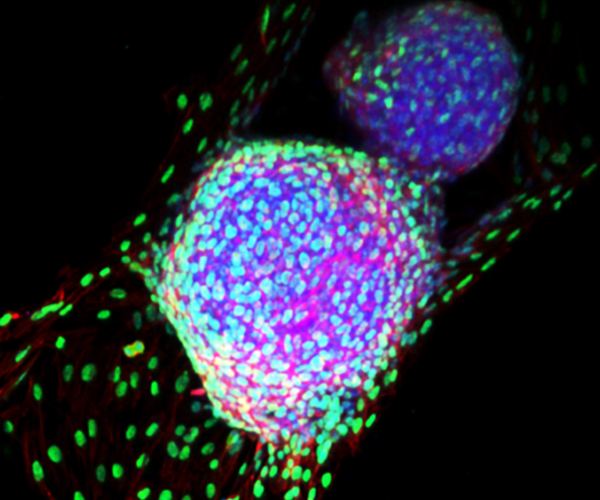 Ovario bioprotésico creado por investigadores financiados por el NICHD, con ovocitos (púrpura/azul) y folículos (verde), para mejorar la fertilidad en mujeres con cáncer.