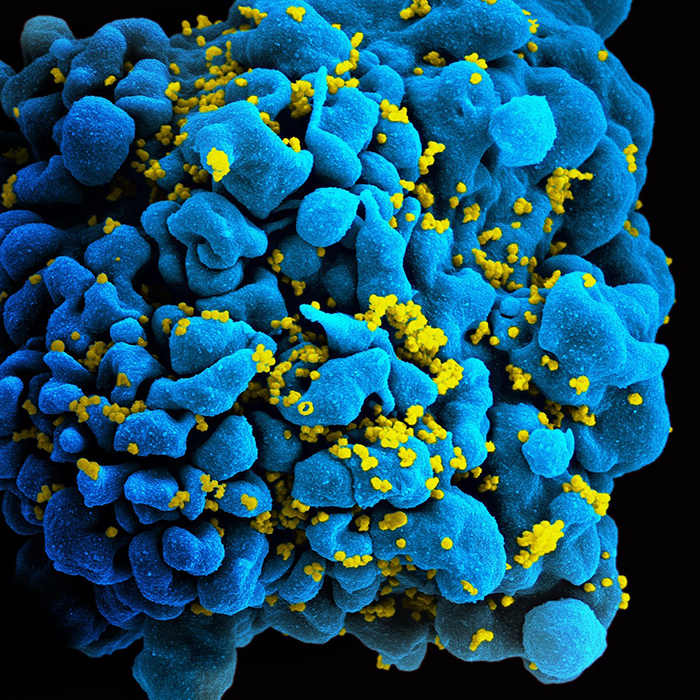 Célula inmune con numerosos virus de inmunodeficiencia humana en su superficie.