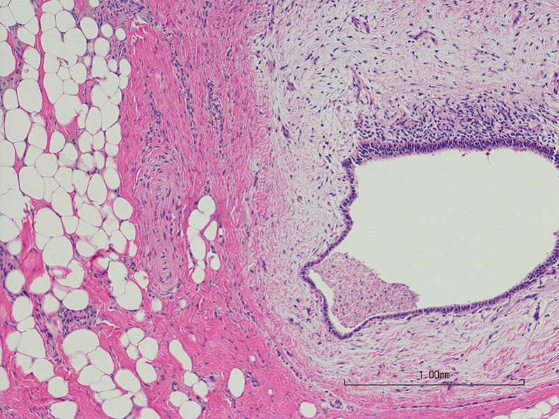 Imagen microscópica de células endometriales.
