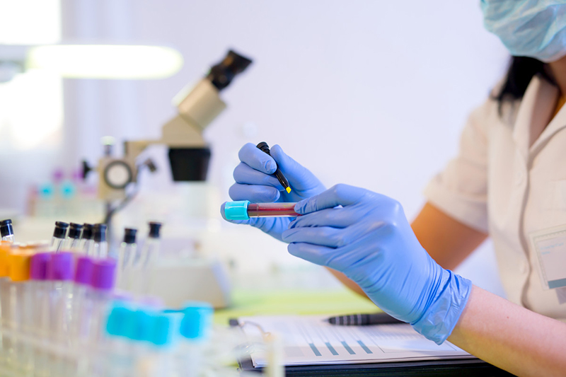 Un trabajador de laboratorio etiqueta un tubo de sangre entre filas de tubos de ensayo vacíos y un microscopio.