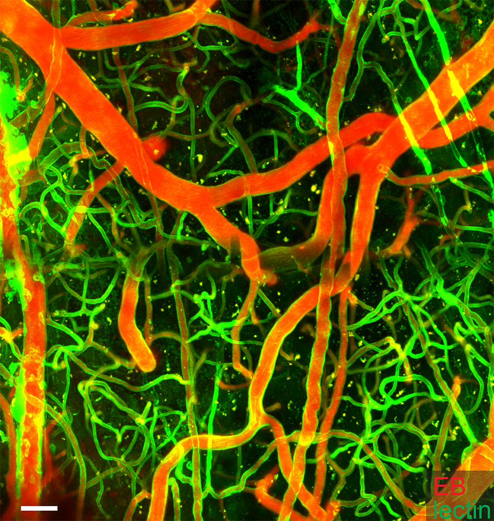 Imagen microscópica con los vasos sanguíneos marcados en rojo y verde fluorescentes.