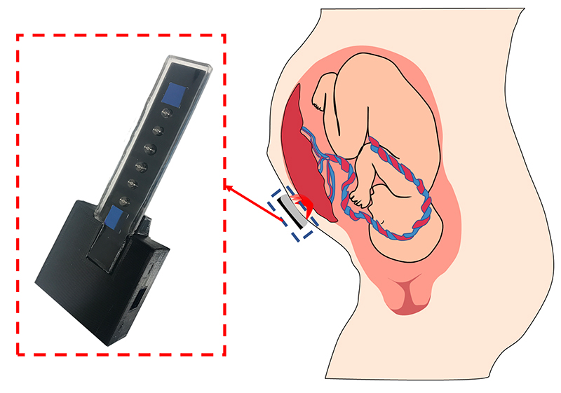 El sensor de oxígeno junto a un diagrama del feto y la placenta en el útero.