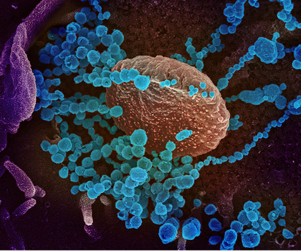 Imagen de microscopía del SARS-CoV-2.
