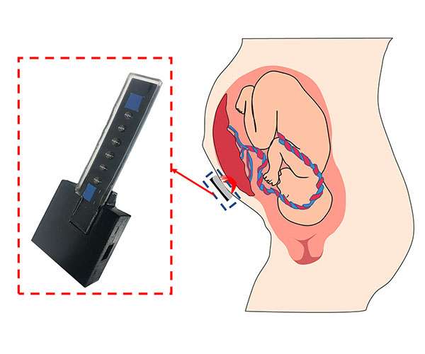 El sensor de oxígeno prototipo junto al diagrama de un feto con una placenta orientada hacia adelante.