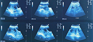 Varias imágenes de ultrasonido.