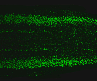 Los puntos verdes son visibles contra un fondo negro. El espectro de puntos es mayormente simétrico, y la columna espinal va de izquierda a derecha. 