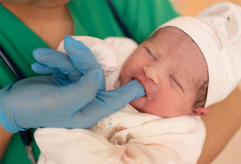 Mano con guante insertando el dedo dentro de la boca de un bebé.