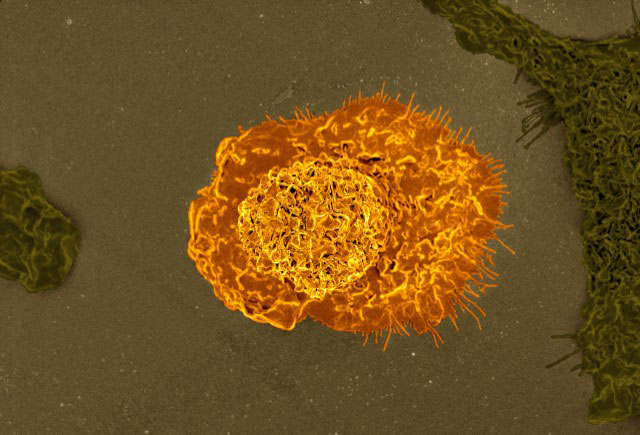 Micrografía electrónica de barrido coloreada de un macrófago.
