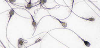 Células de esperma.