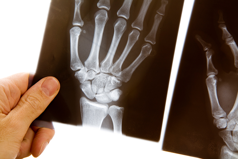 Aparece una imagen de rayos X de una mano sujetada por la mano de otra persona.
