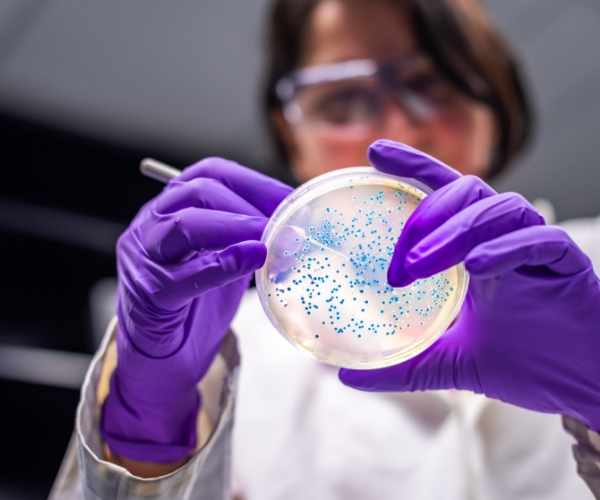 Una científica con guantes morados califica una placa de cultivo bacteriano. La placa es redonda, recubierta con agar transparente y las colonias bacterianas son puntos azules.