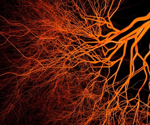 Una masa fibrosa de vasos capilares de color rojo anaranjado sobre un fondo negro se ramifica desde la esquina superior derecha hasta la esquina inferior izquierda.