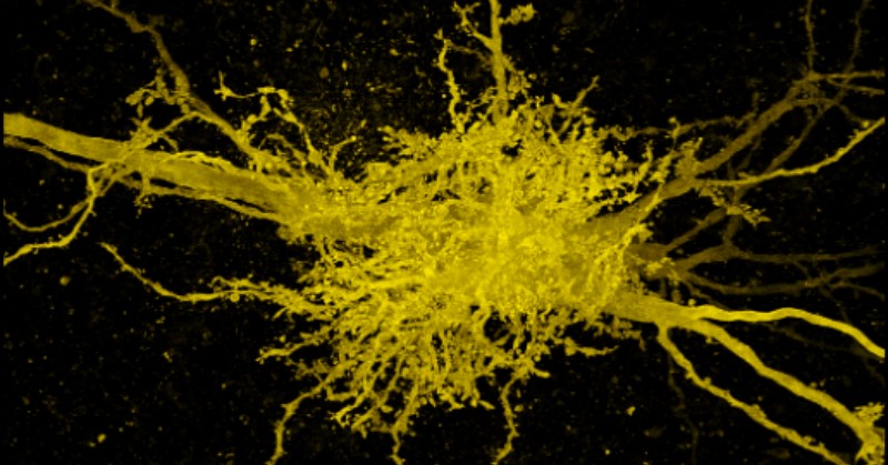 Imagen microscópica de células amarillas sobre un fondo negro. La unión central contiene muchas proyecciones en forma de vasos. Los axones de las dos neuronas son más gruesos y se extienden desde arriba a la izquierda hasta abajo a la derecha.