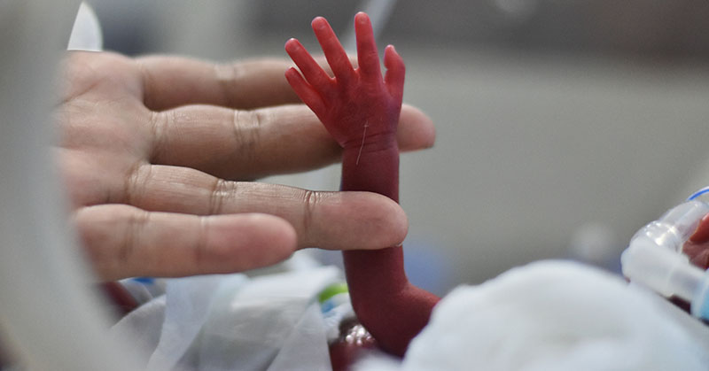 Mano de un adulto sujetando el brazo de un bebé prematuro.