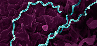 Bacterias en forma de espiral resaltadas en verde azulado sobre un fondo morado.