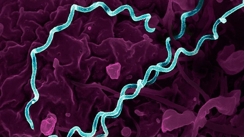 Bacterias en forma de espiral resaltadas en verde azulado sobre un fondo morado.