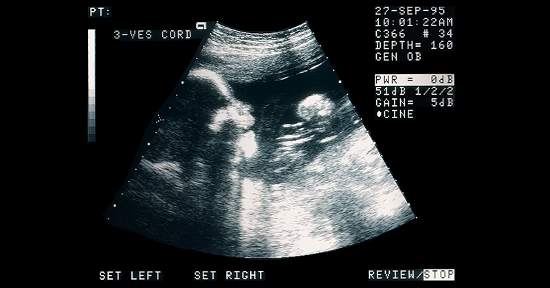 Ecografía de un feto.