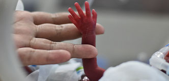 La mano de un adulto sujetando el brazo y la mano pequeños de un bebé prematuro.
