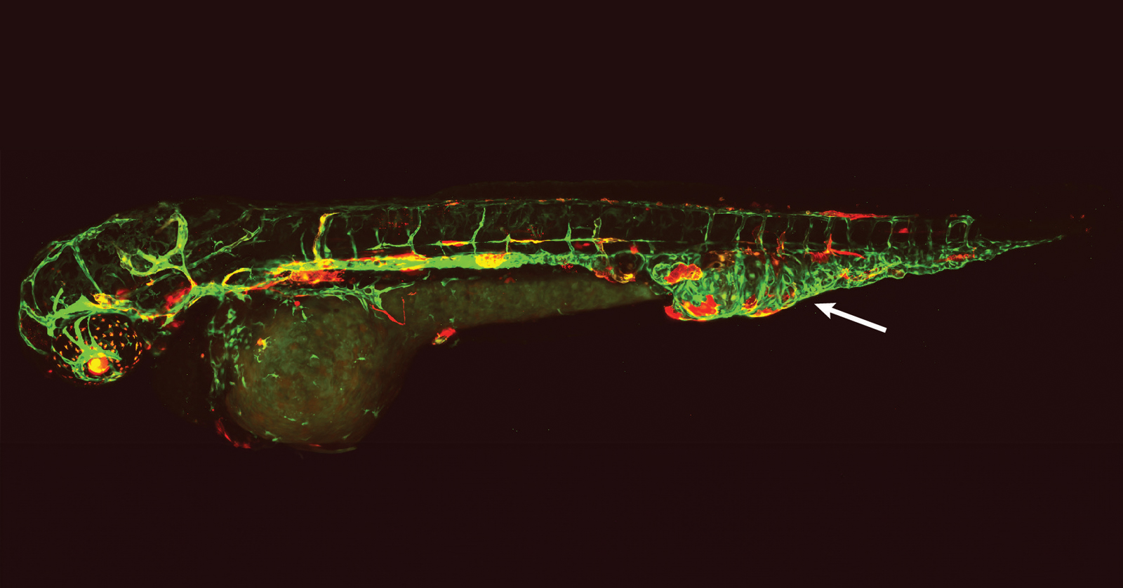 Un pez cebra con los vasos linfáticos y sanguíneos marcados con fluorescencia y una malformación vascular en la cola.