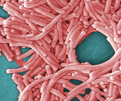 Imagen microscópica de un gran grupo rosado de bacterias en forma de bastón sobre un fondo azul.