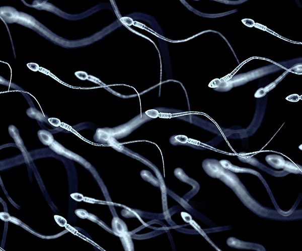 Imagen microscópica de espermatozoides, cada uno de los cuales tiene una cabeza redonda y una cola larga y fina.