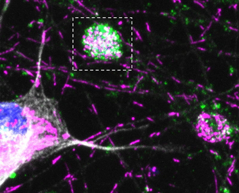 Las mitocondrias moradas y los autofagosomas verdes aparecen como líneas y manchas sobre un fondo negro. En el centro aparece una gran bola morada, verde y blanca que representa la inflamación del axón y está delimitada por una línea discontinua blanca. El cuerpo celular de la neurona es visible en la parte inferior izquierda.