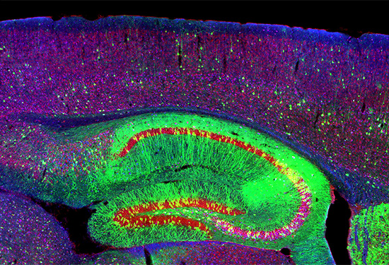 Microscopía del cerebro de un ratón con la enfermedad Niemann-Pick de tipo C1. 