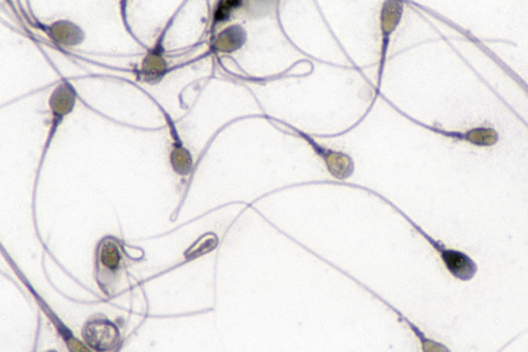 Imagen microscópica de espermatozoides que parecen estar inmovilizados.