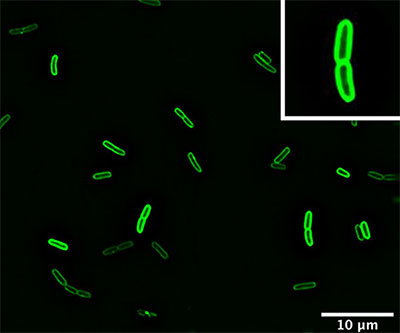 Bacterias fluorescentes con forma de bastón. Un recuadro en la esquina superior derecha muestra un primer plano. 