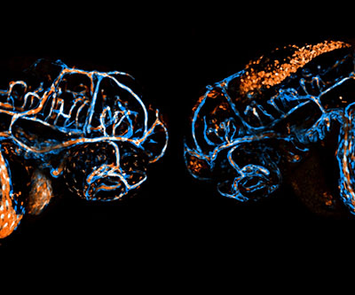La imagen microscópica muestra colores fluorescentes sobre un fondo negro. La cabeza del embrión mutante tiene un gran grupo de células sanguíneas de color naranja. 