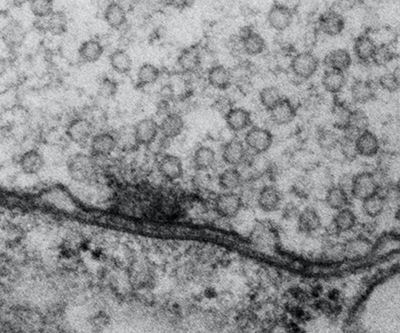 Imagen de microscopía en blanco y negro que muestra la unión entre dos células nerviosas.