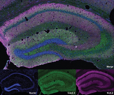 La imagen superior muestra la sección del cerebro con tinción fusionada. La fila inferior contiene tres imágenes con tinciones separadas para (de izquierda a derecha) núcleos, Cav2.3 y Kv4.2.