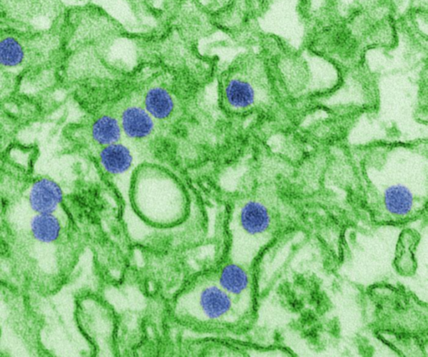Una imagen de microscopía coloreada digitalmente del virus Zika. La imagen muestra puntos azules sobre un fondo verde. Los puntos azules son partículas de virus.