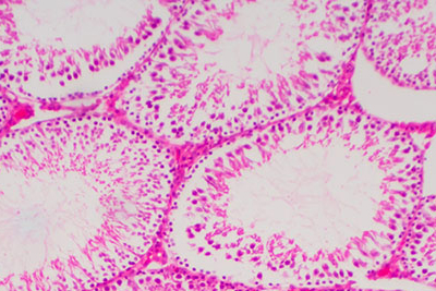 Morfología del esperma humano en el testículo debajo del microscopio.