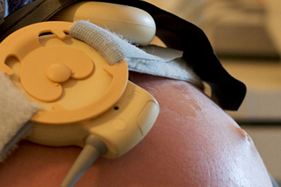 Sensores conectados al abdomen de una paciente embarazada en una sala para exámenes médicos.