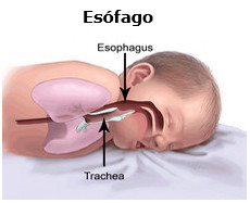 Un bebé acostado de panza, en que el esófago (tubo hacia el estómago) se encuentra arriba la tráquea (tubo hacia los pulmones.)